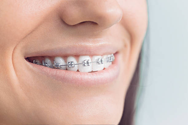 Dental Inlays and Onlays in Horseshoe Bend, AR